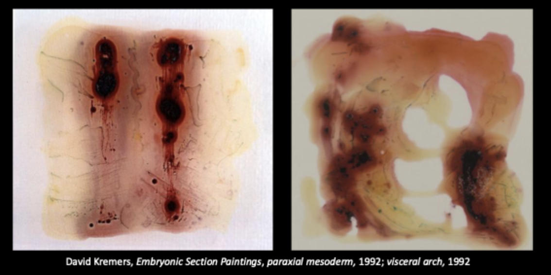 David Kremens, Embryonic Section Paintings: Paraxial Mesoderm and Visceral Arch, 
1992.