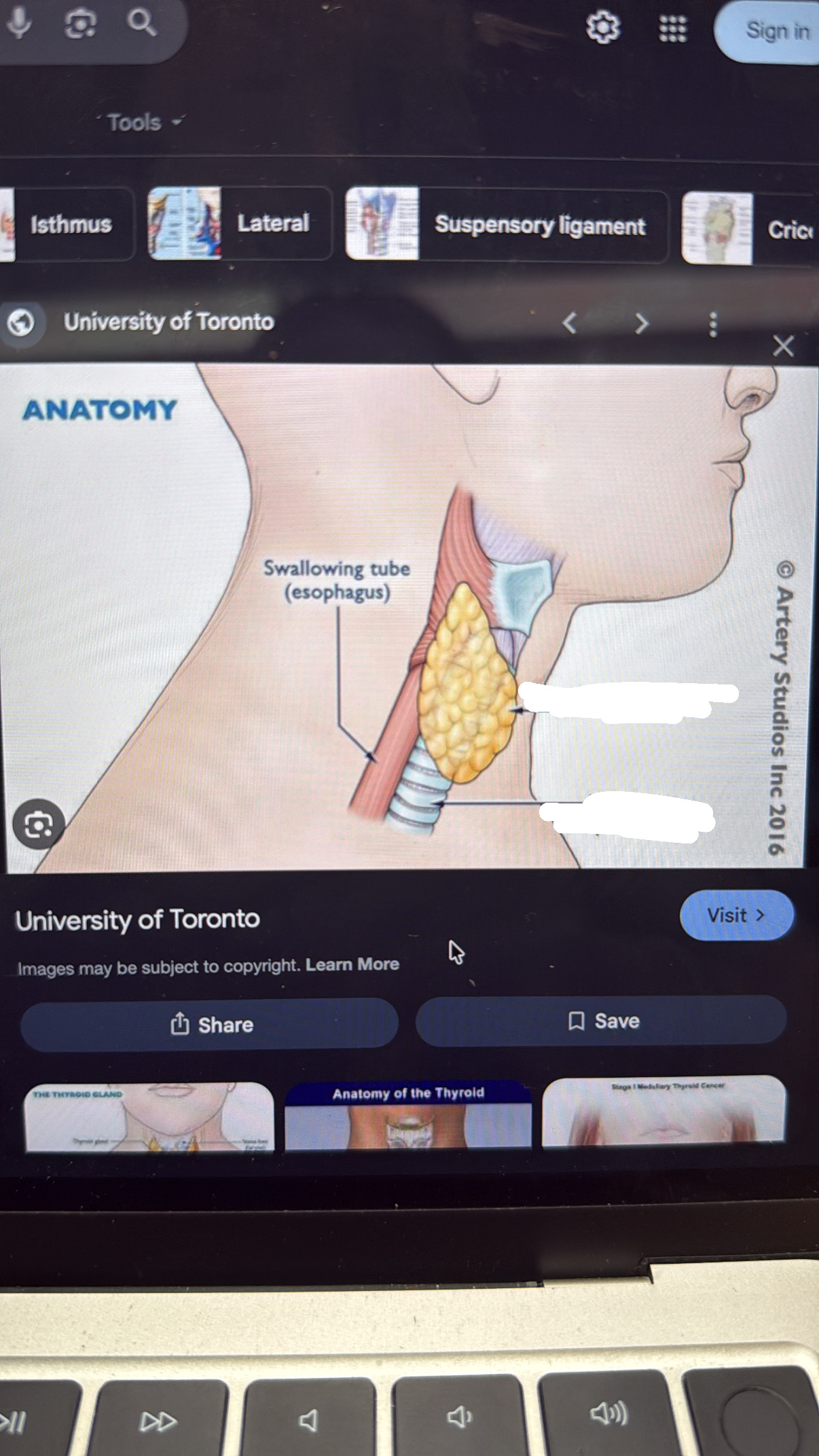 <p>notches down throat (windpipe)</p>