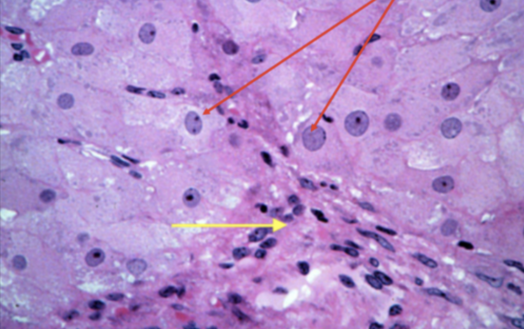 <p>yellow and red</p>