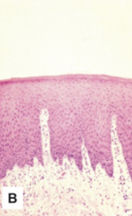 <p>This image depicts</p>