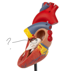 <p>Name this structure (hint: separates a ventricle from to a vessel)</p>