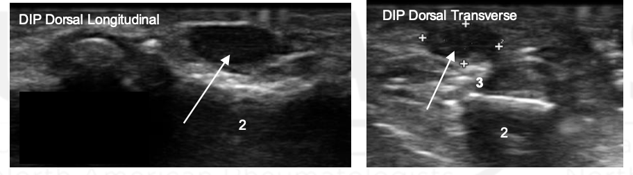 <p>What is the arrow pointing to?</p>