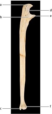 <p>Identify the bone feature labeled “c.”</p><p>a. radial notch</p><p>b. styloid process</p><p>c. head</p><p>d. coracoid process</p>