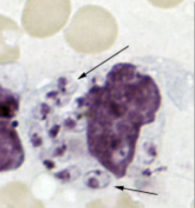 <p>_______________________ would show up as i<span style="background-color: transparent;">ntracellular amastigotes inside of macrophages on blood smear. </span></p>