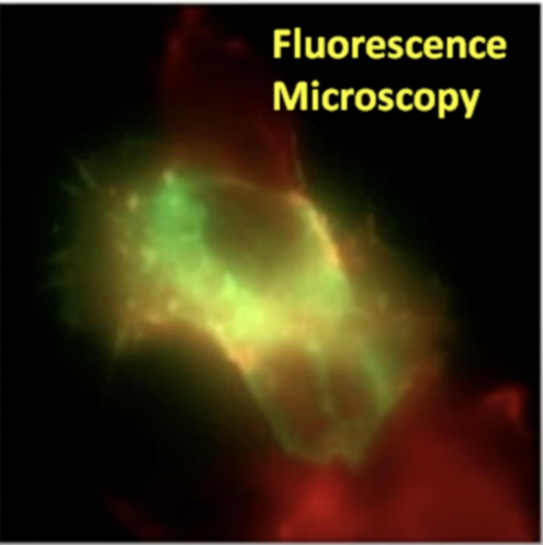 <p>Utilises fluorescent dyes, proteins. or antibodies to label specific cellular components or molecules. It enables visualisation of specific proteins, organelles, or structures within cells </p>