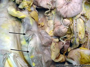 <p>what structure on the large intestine is this (be specfic)?</p>