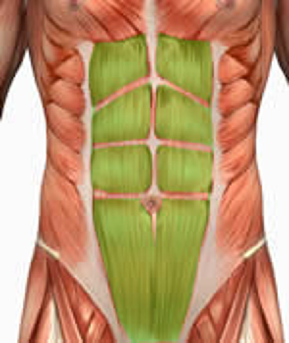 <p>Medial muscle pair of anterior and lateral abdominal wall</p><p>Extend from pubis to ribcage</p><p>*Flexes and rotates lumbar region of vertebral column</p>