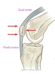 <p>When the leg is flexed, how is the patella positioned?</p>