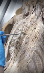 <p>Name the muscle</p><p>- specific area of spinalis</p>