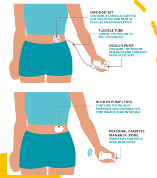 <ul><li><p>sources of error</p></li><li><p>risks of error</p></li><li><p>how would you address the errors</p></li><li><p>design improvements</p><ul><li><p>therapeutic</p></li><li><p>aesthetic</p></li></ul></li><li><p>priority  (demographic)</p></li></ul><p></p>