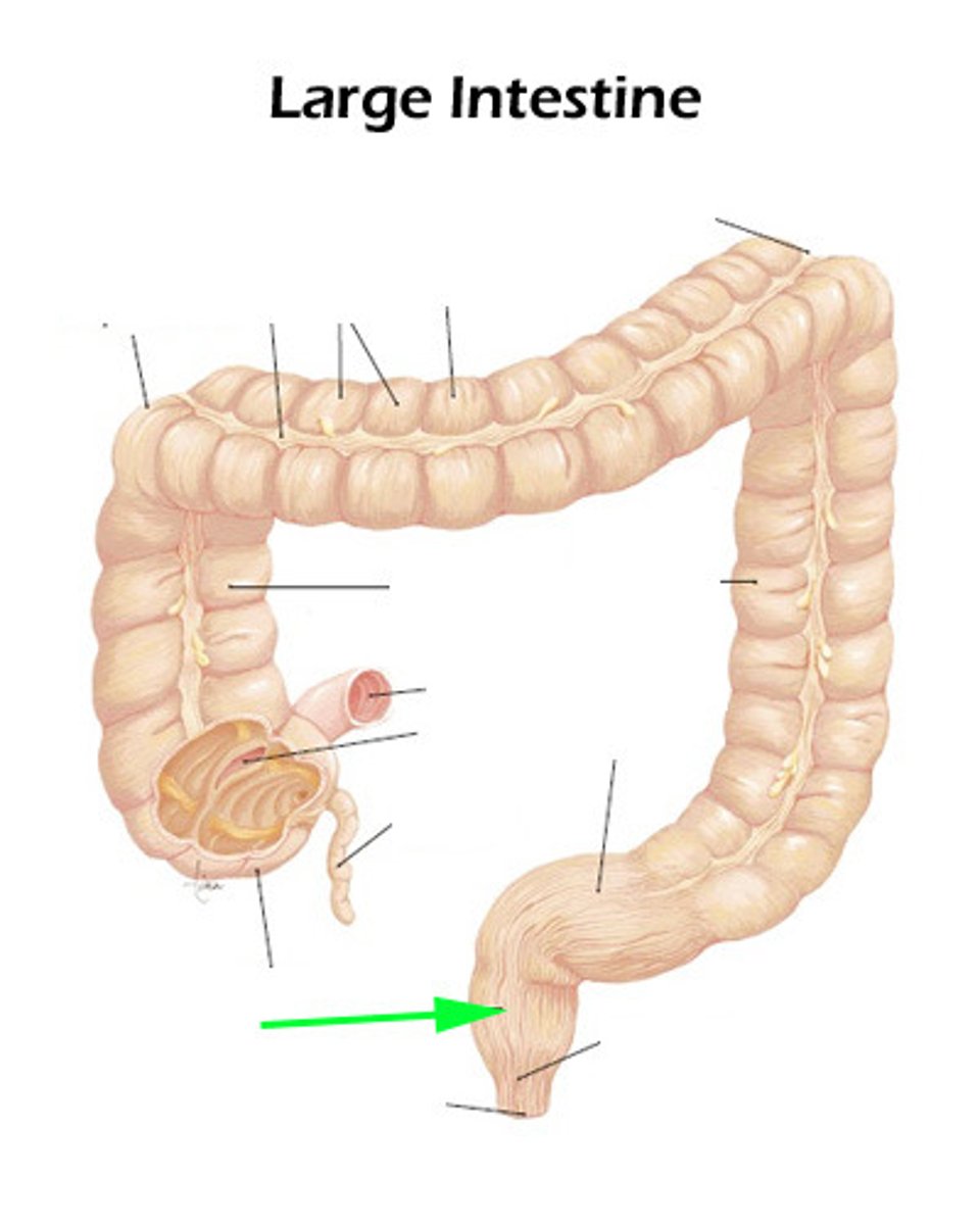 knowt flashcard image