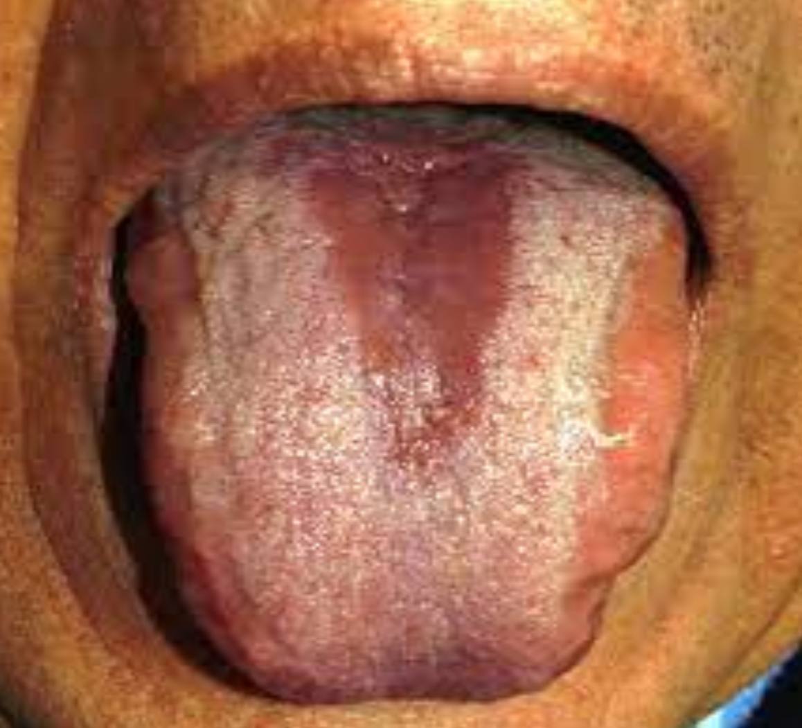<p>• Name of lesion:</p><p>• Causative organism:</p><p>• Describe the lesion:</p>