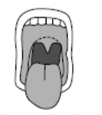 <p>what mallampati is this </p>