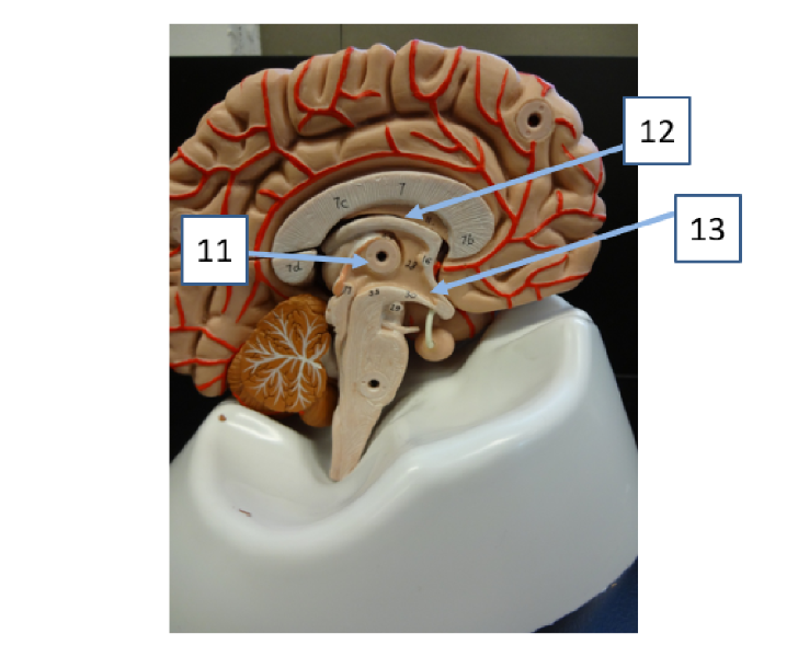 <p>What structure is #12</p>