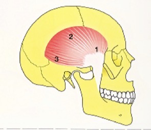 <p>Fan shaped</p><p>Anterior, medial, posterior portion</p><p>Contraction of anterior portion elevates jaw , medial and posterior elevate and retract</p>