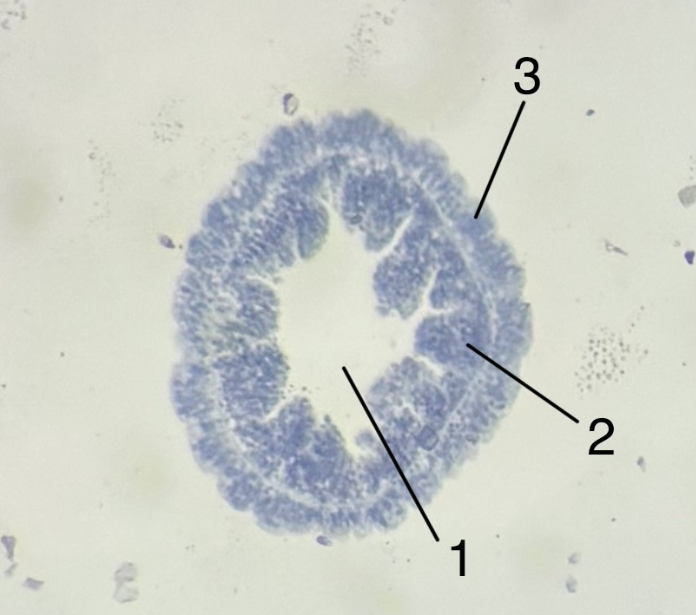<p>What is 1?</p>