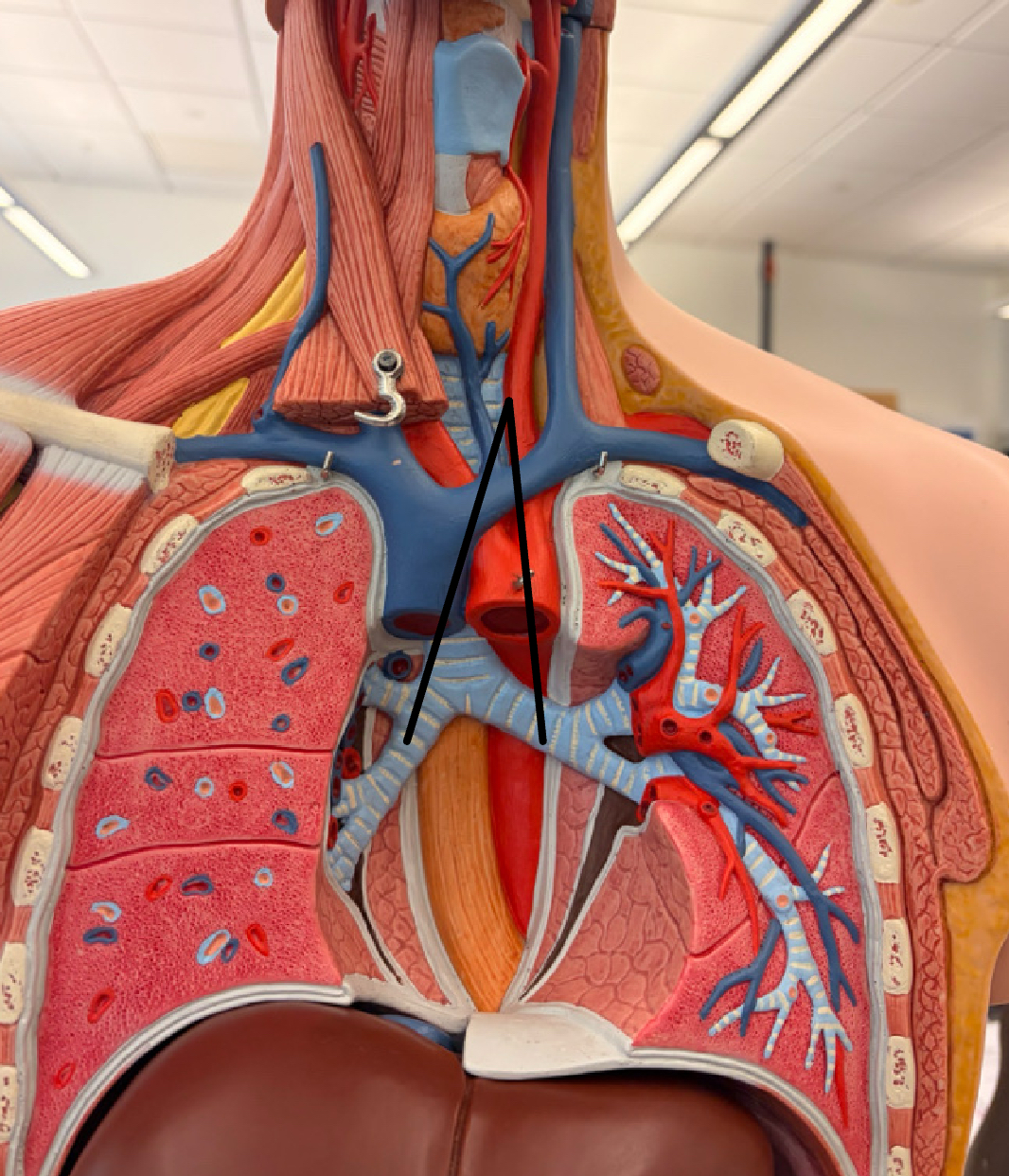 <p>the two passageways that branch off the trachea and lead to the right and left lungs</p>