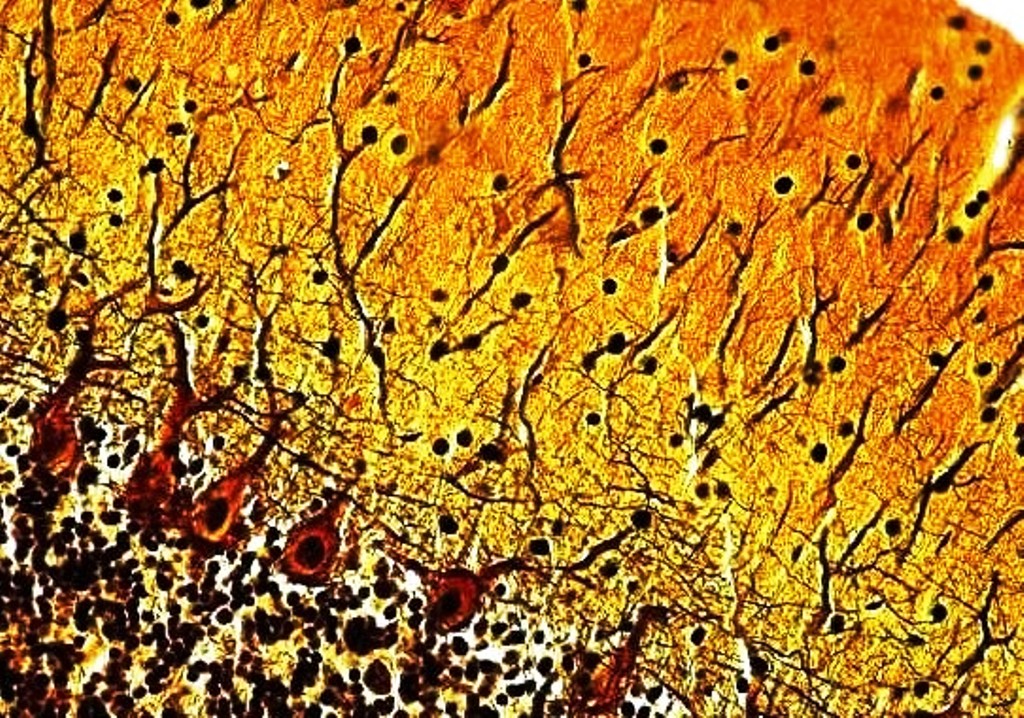 <p>Identifica la plaquita</p>