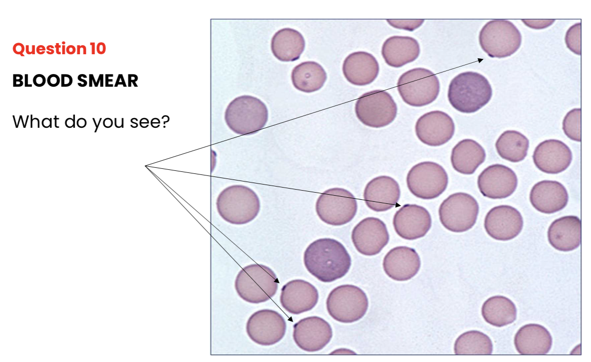 <p>What do you see?</p>