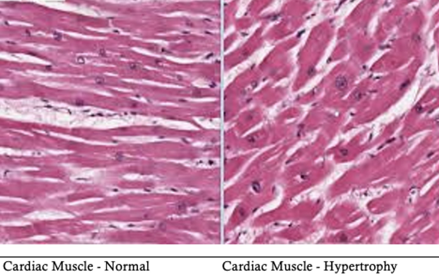 <p>increase in cell size</p>