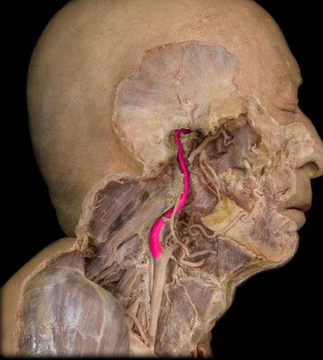 term image