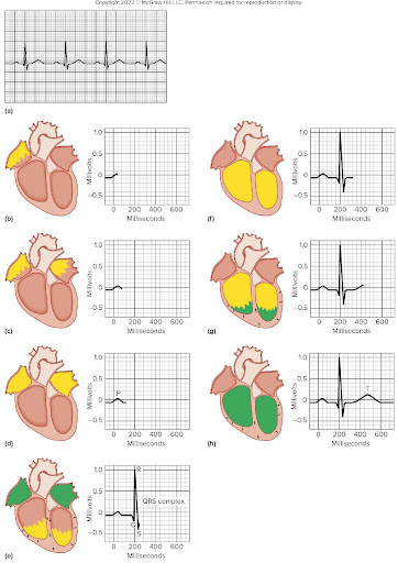 <p>Electrocardiogram: <span style="background-color: transparent;">A recording of electrical changes that occur in the myocardium during the cardiac cycle</span></p><ul><li><p><span style="background-color: transparent;">Used to assess ability of heart to conduct impulses</span></p></li><li><p><span style="background-color: transparent;">The deflections in the normal ECG, or waves, include:</span></p><ul><li><p><span style="background-color: transparent;"><strong>P wave: </strong>Atrial depolarization; occurs just prior to atrial contraction</span></p></li><li><p><span style="background-color: transparent;"><strong>QRS complex</strong> (3 waves): Ventricular depolarization; occurs just prior to ventricular contraction</span></p></li><li><p><span style="background-color: transparent;">Record of atrial repolarization is “hidden” in the large QRS complex, since ventricular depolarization is a much larger event</span></p></li><li><p><span style="background-color: transparent;"><strong>T wave: </strong>Ventricular repolarization; occurs just prior to ventricular relaxation</span></p></li></ul></li></ul><p></p>