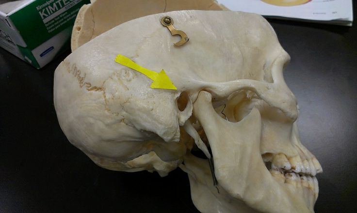 <p>What feature of the skull is this?</p>