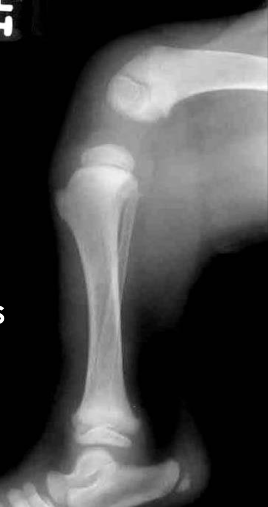 <p>Why were there crazy gaps?</p>