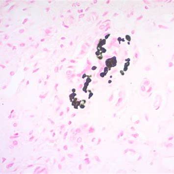 <p><em>Abcam. (n.d.). Von Kossa-stained bone demonstrating calcium deposits [Photomicrograph].</em></p>