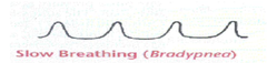 <p>B. bradypnea</p>