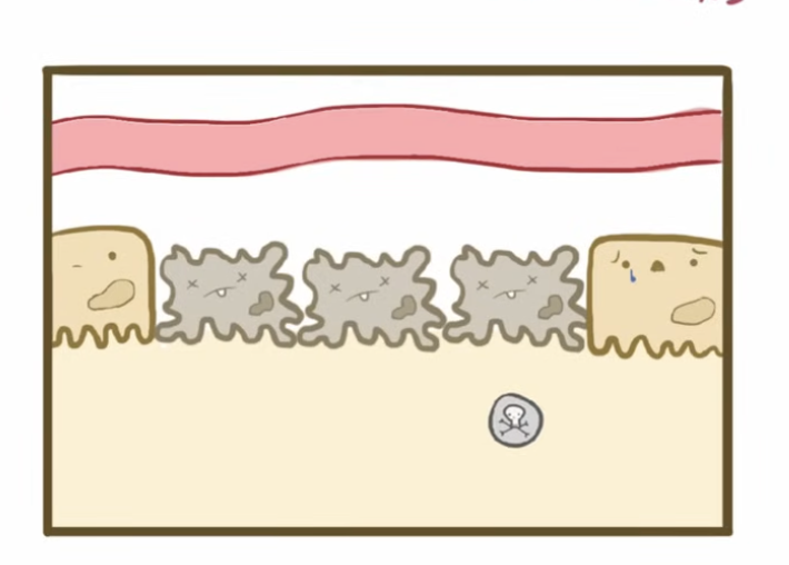<p>Intrarenal AKI</p>