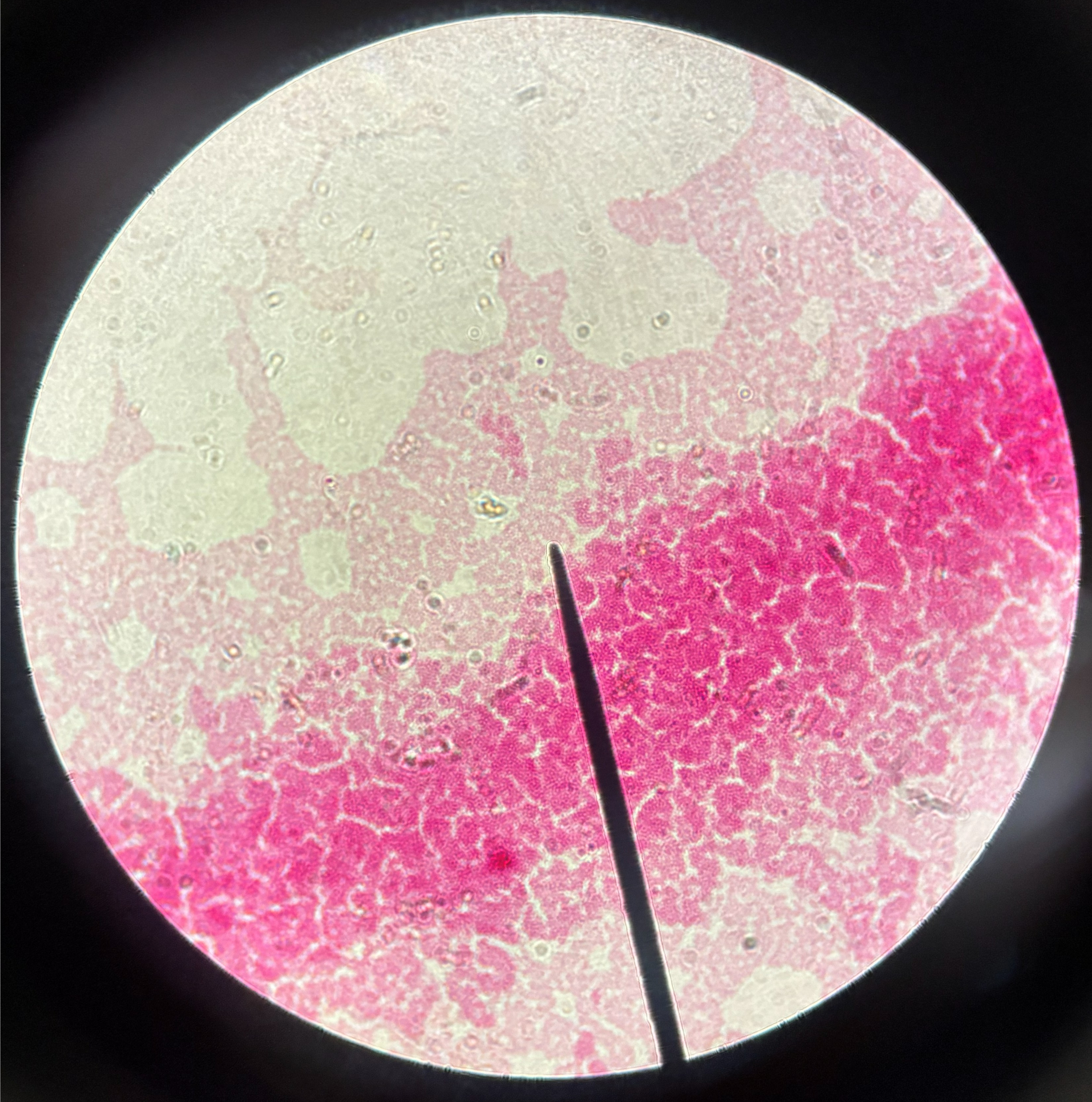 <p>What is the shape of this bacteria?</p>