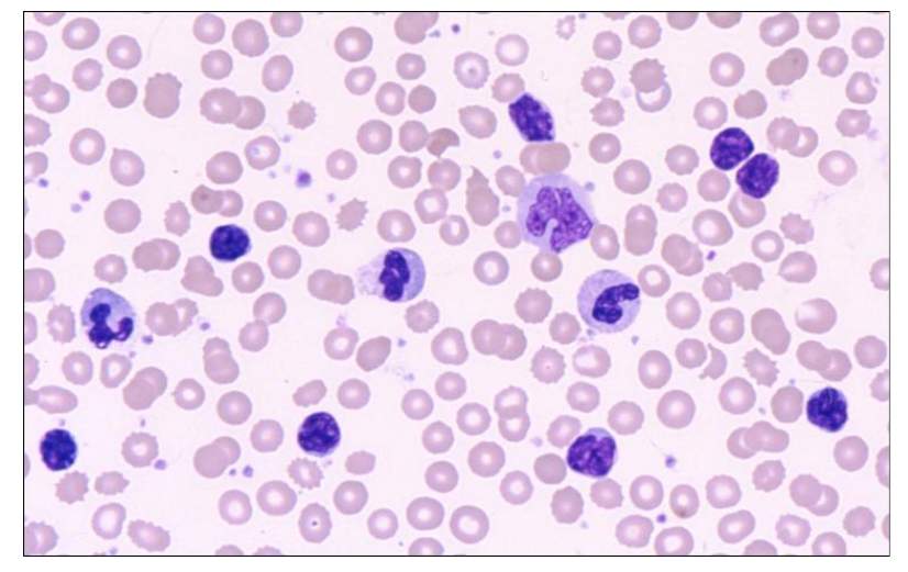 <p>Which of the cells in this image are neutrophils</p>