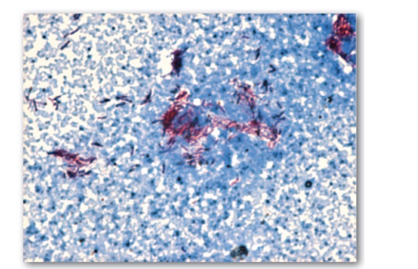 <p>Acid-fast stain</p>