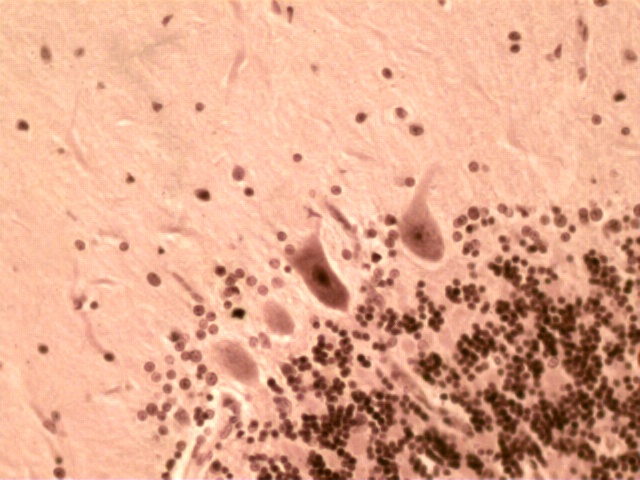 <ul><li><p>common in the cerebellum</p></li><li><p>large cells in the brain</p></li><li><p>important in motor regulation</p></li></ul><p></p>