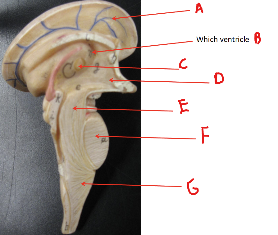 <p>Label F</p>
