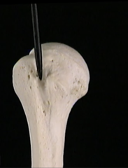<p>What structure is the arrow pointing to?</p>
