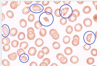 <p>what type of erythrocyte cell is this?</p>