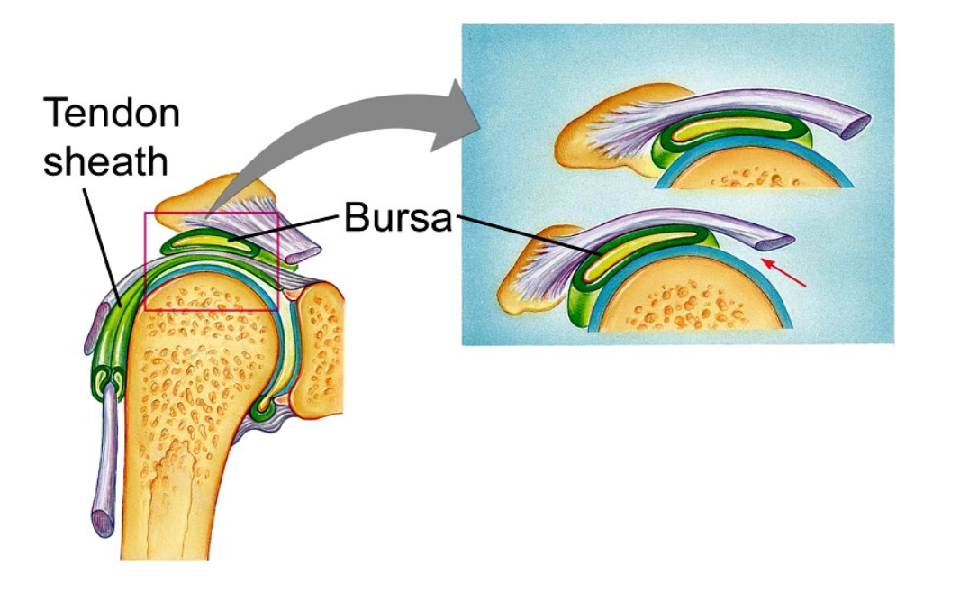 <p>Burse = rolls along with movement (like a ball) which stops friction</p>