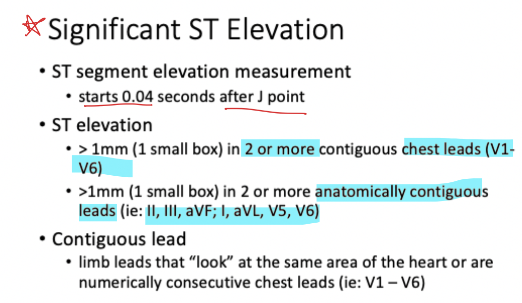 <p><strong>Treat as significant</strong>, as these are <em>contiguous inferior leads</em></p>