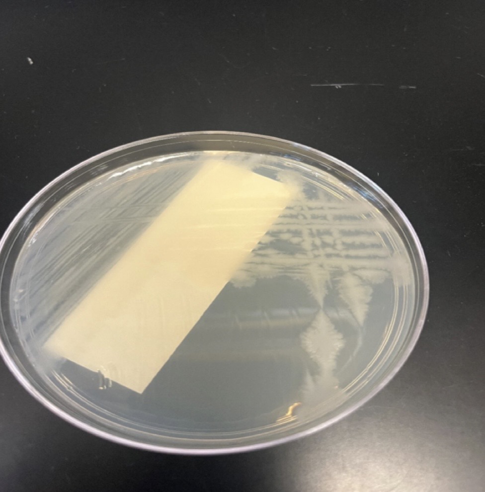 <p>Bacillus cereus</p>