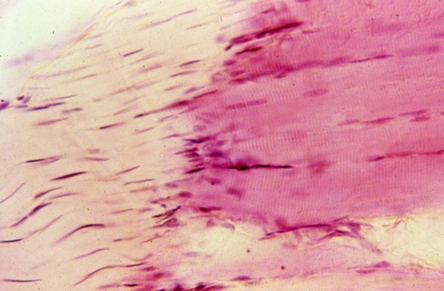 <p>Type I collagen condenses into what?</p>