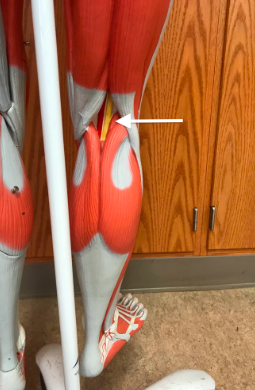 <p><span>Name the muscle labeled with the white arrow below:</span></p>