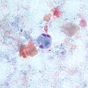<p>Smaller (5-10 um) but like E. histolytica</p><p>Small chromatid bodies</p>