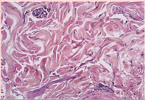 <p>Protein fibers arranged in a randomly oriented network which provides strength and structural reinforcement for the joint</p>
