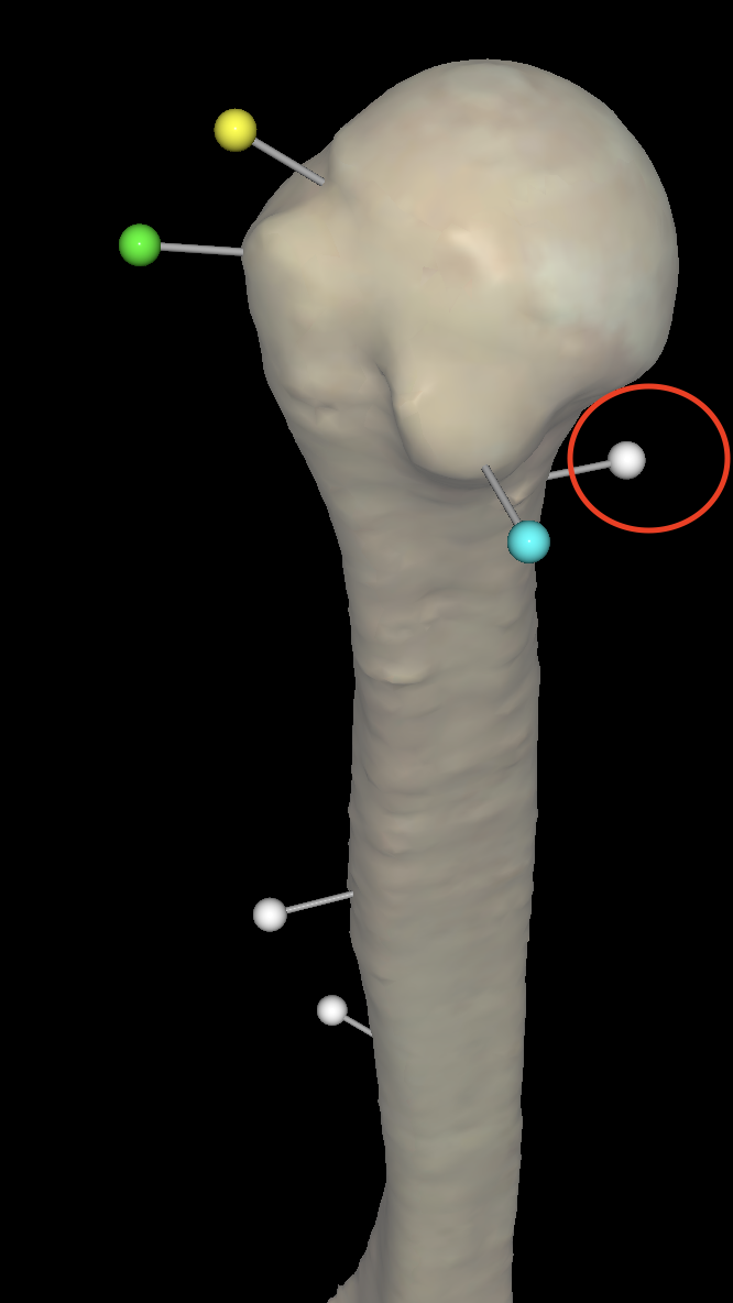 <p>What is the circled pin called on the right humerus?</p>