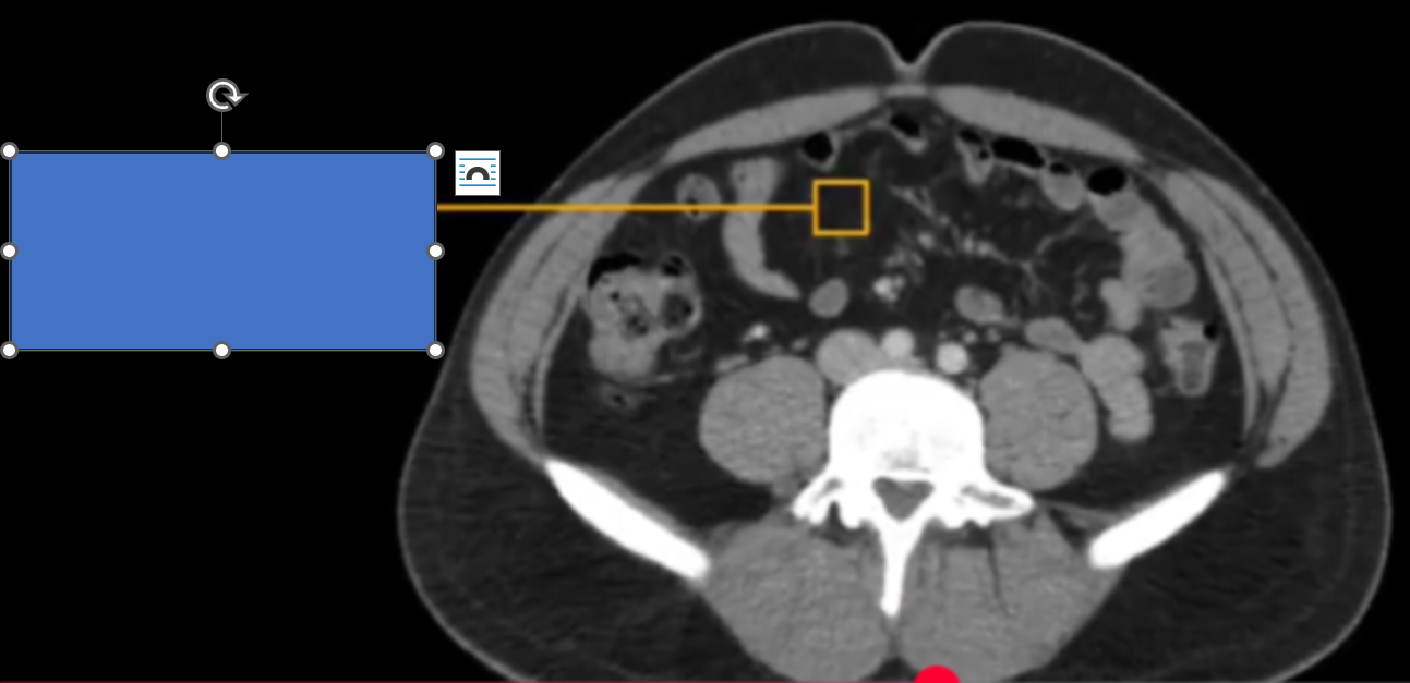 <p>rốn ở đâu?</p><p>cq trong hình ?</p>