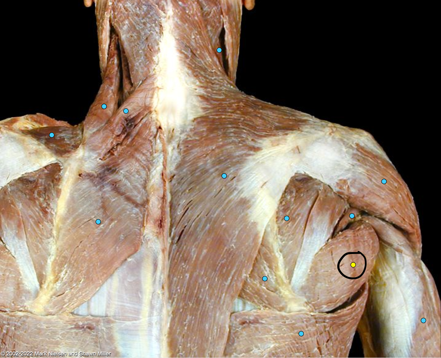 term image