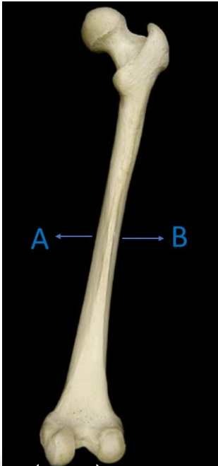 <p>Which letter on the image indicates the medial side and which one indicates the lateral side of the femur?</p>