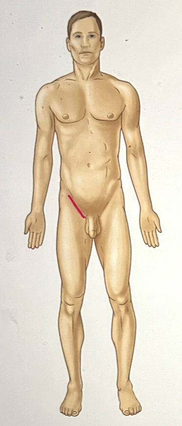 <p>identify the body region</p>